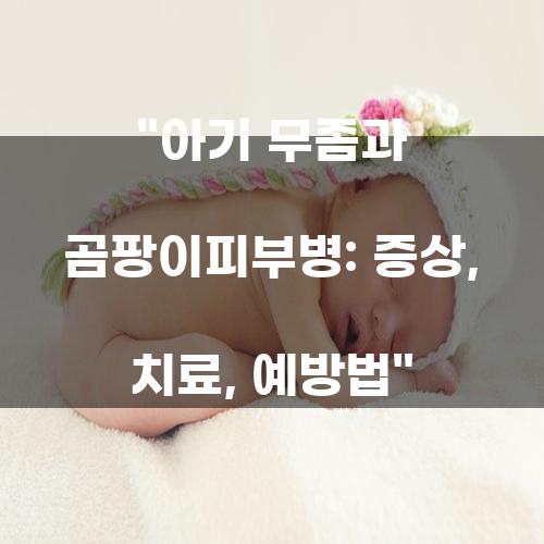 아기 무좀과 곰팡이피부병: 증상, 치료, 예방법