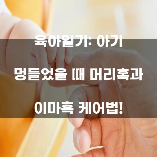 육아일기: 아기 멍들었을 때 머리혹과 이마혹 케어법!