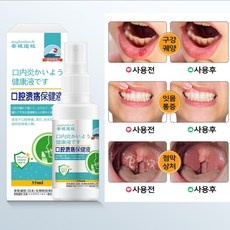 필수 품목 구내염빨리낫는법 최저가 제품 BEST 5