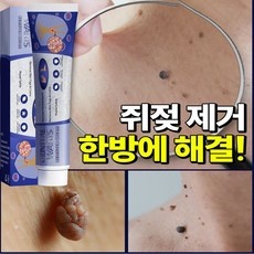 놓치면 손해보는 에스로반 추천 정보 TOP 5