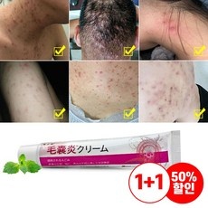 유튜브 인기 에스로반연고 최저가 상품 BEST 5
