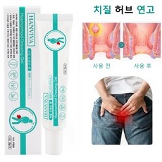 꼭 봐야하는 치센 인기 아이템 TOP 5