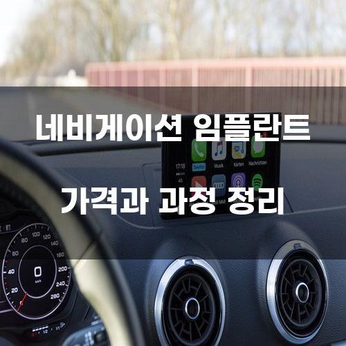 네비게이션 임플란트 가격과 과정 정리