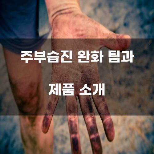 주부습진 완화 팁과 제품 소개
